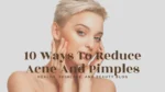 10 Ways To Reduce With Acne And Pimples