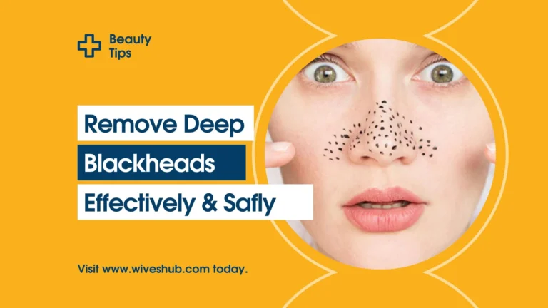 How to Remove Deep Blackheads Safely & Effectively