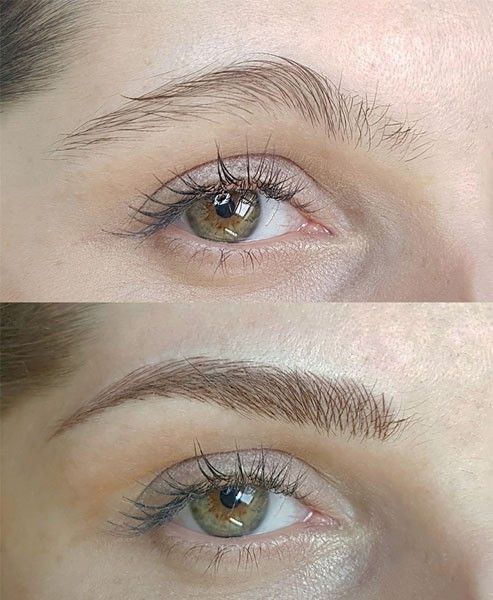 Eyebrow Reconstruction 6D